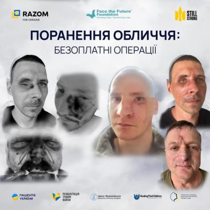 Американські та канадські хірурги у Франківську оперуватимуть мінно-вибухові травми обличчя