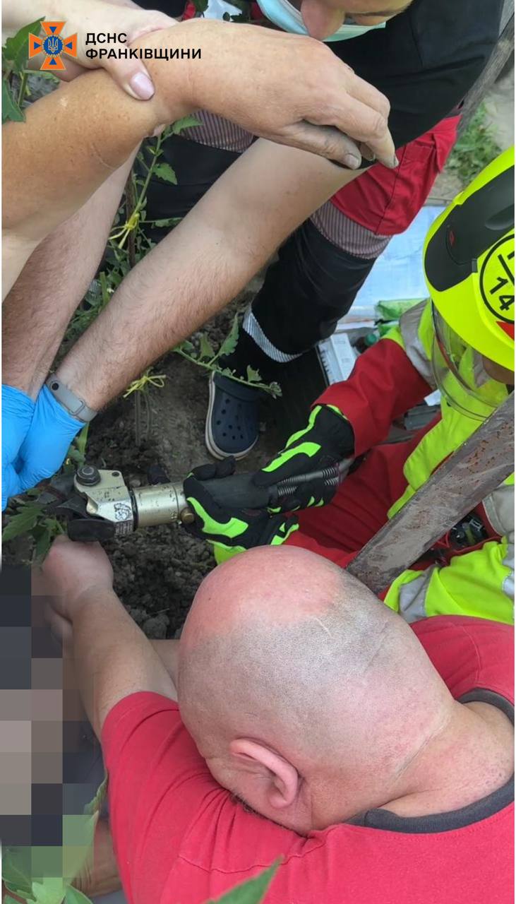 За попередньою інформацією, жінка підвернула ногу та впала на металевий стрижень, який пробив їй руку.